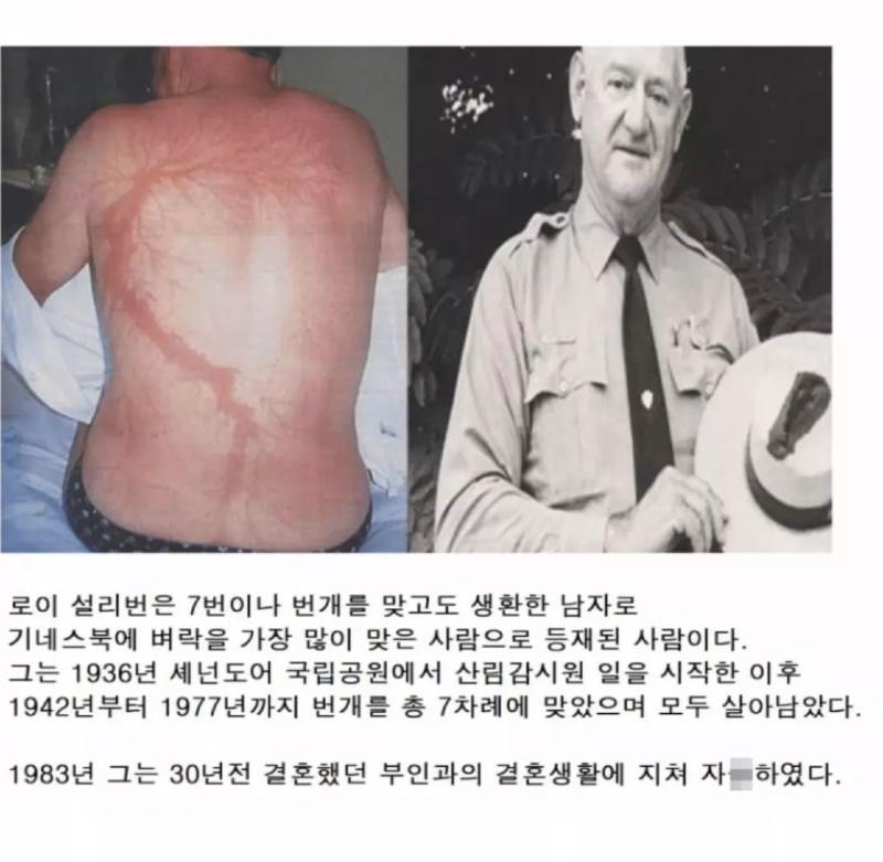 번개를 7번 맞은것보다 치명적인 것